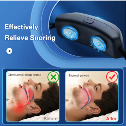 Anti-Snoring Chin Device with Gentle Pulses